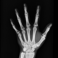 Projectional Radiography Imaging educational video
